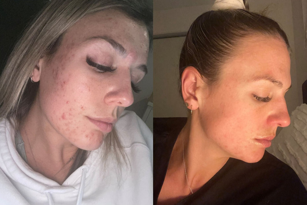 SKIN WITHIN Hair Skin and Nails Collagen supplement