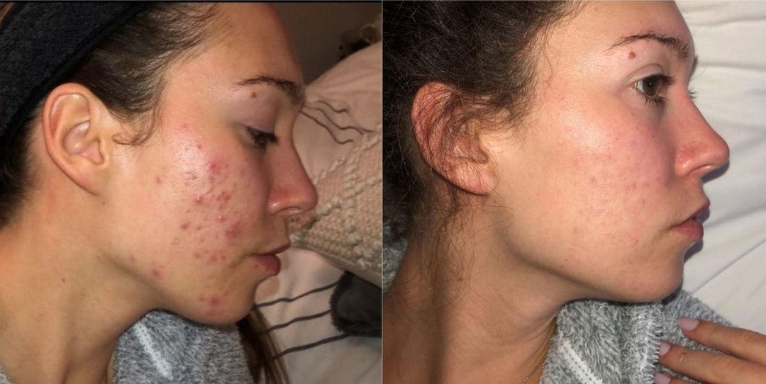 SKIN WITHIN Hair Skin and Nails Collagen supplement