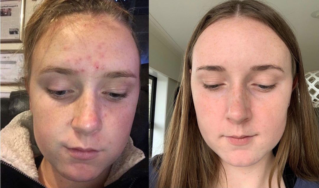 SKIN WITHIN Hair Skin and Nails Collagen supplement