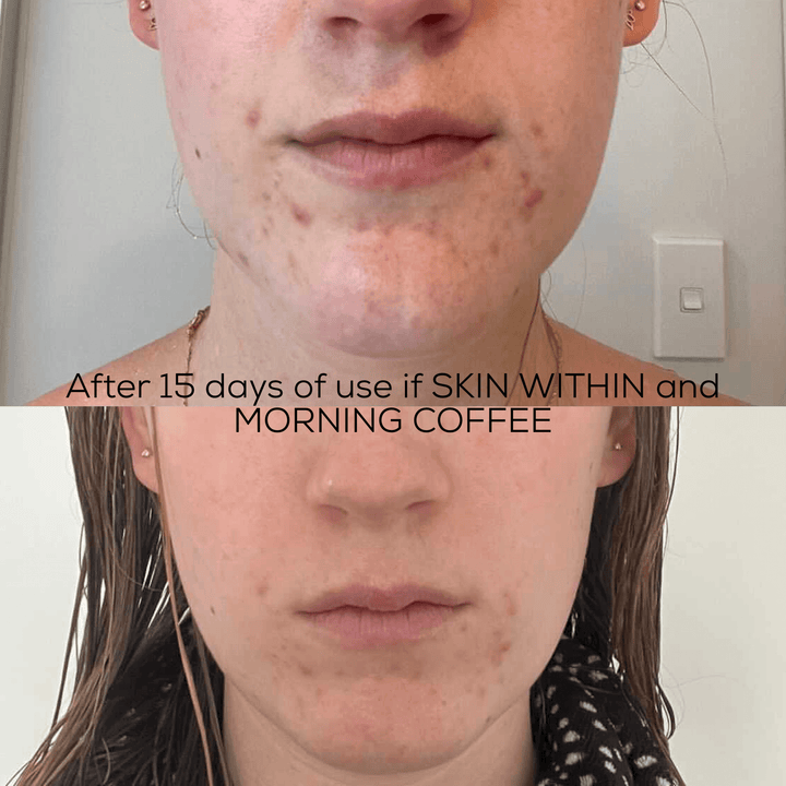SKIN WITHIN Hair Skin and Nails Collagen supplement