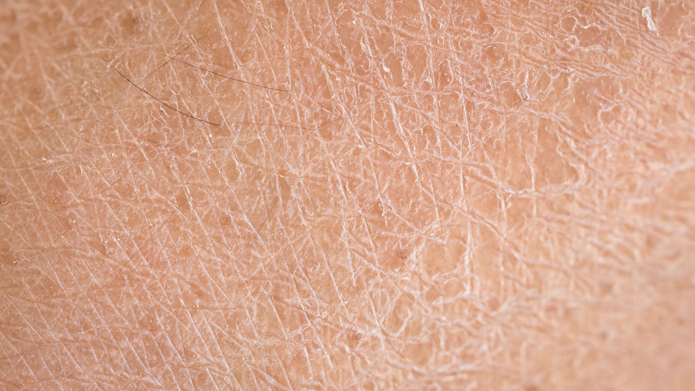 DRY SKIN FACE