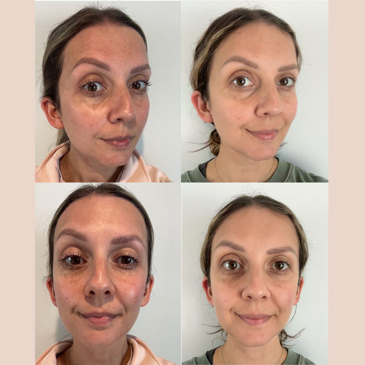 Age-Defy Duo