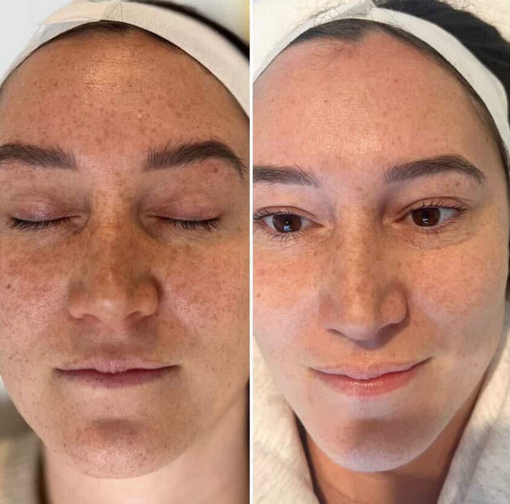Complete Face Care Bundle