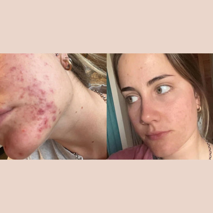 SKIN WITHIN Hair Skin and Nails Collagen supplement