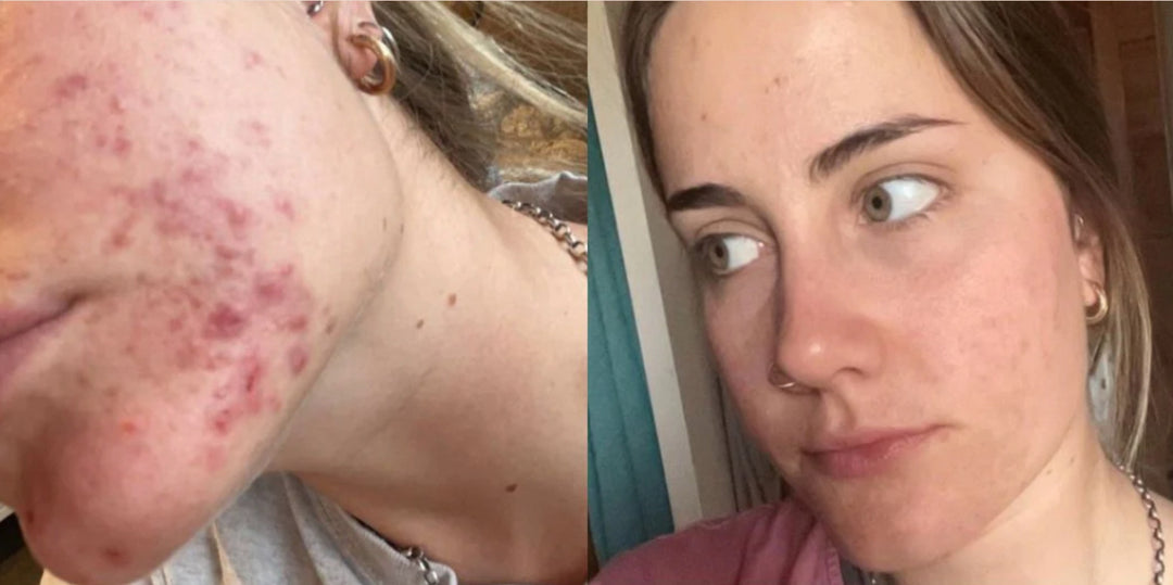SKIN WITHIN Refill and Jar