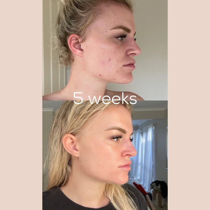SKIN WITHIN Refill and Jar