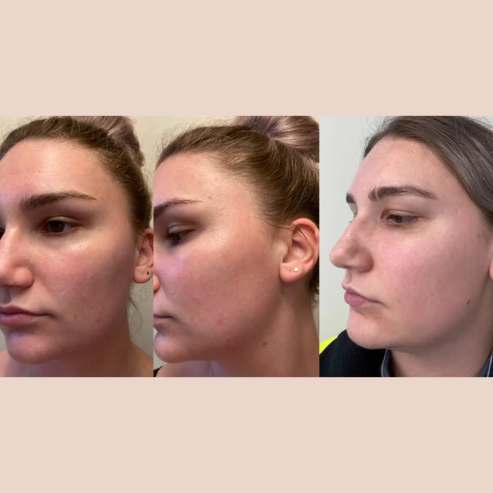 SKIN WITHIN Hair Skin and Nails Collagen supplement