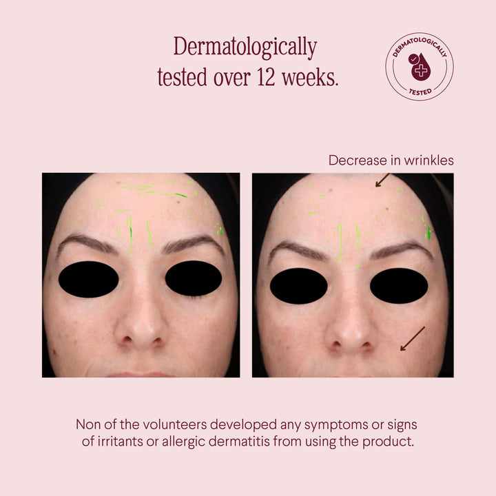 NIGHT CAP Vit A (4%) and Novoretin™ anti aging ointment