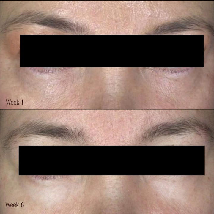 WAKE UP CALL Morning Eye Treatment