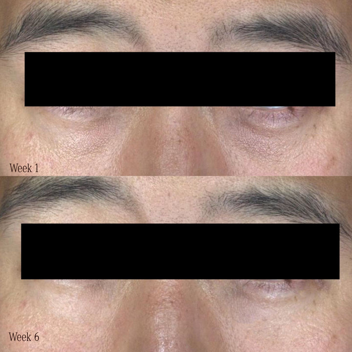 WAKE UP CALL Morning Eye Treatment