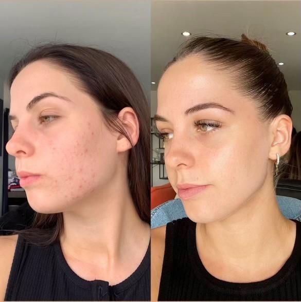 SKIN WITHIN Refill and Jar