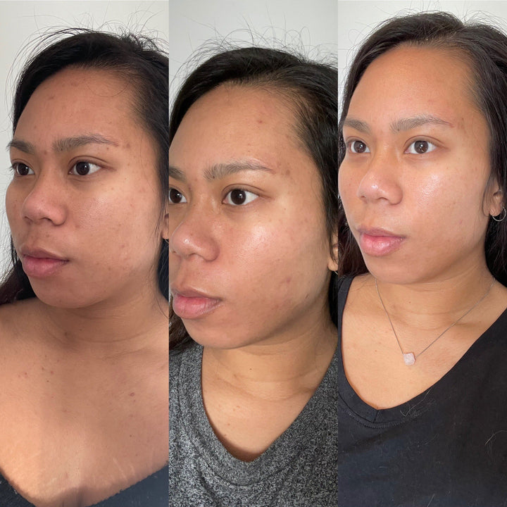 SKIN WITHIN Refill and Jar