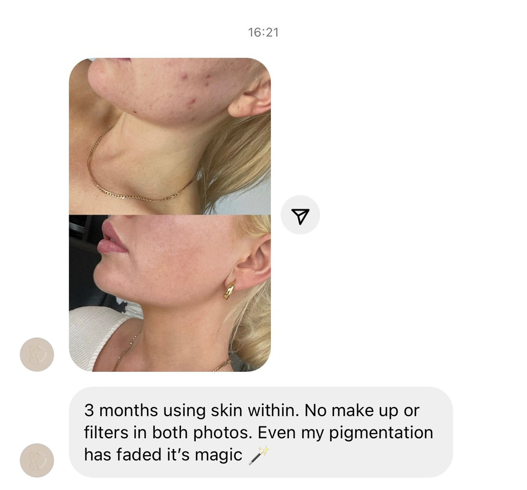 SKIN WITHIN Refill and Jar