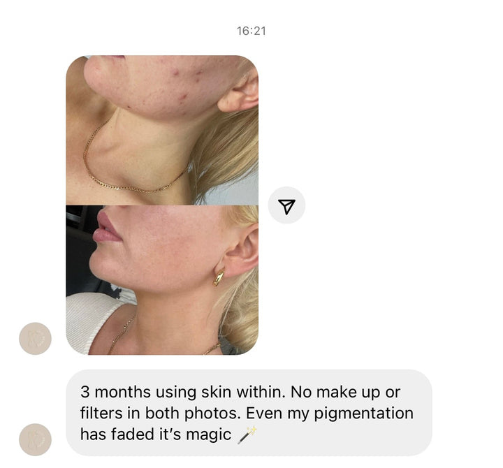 SKIN WITHIN Refill and Jar