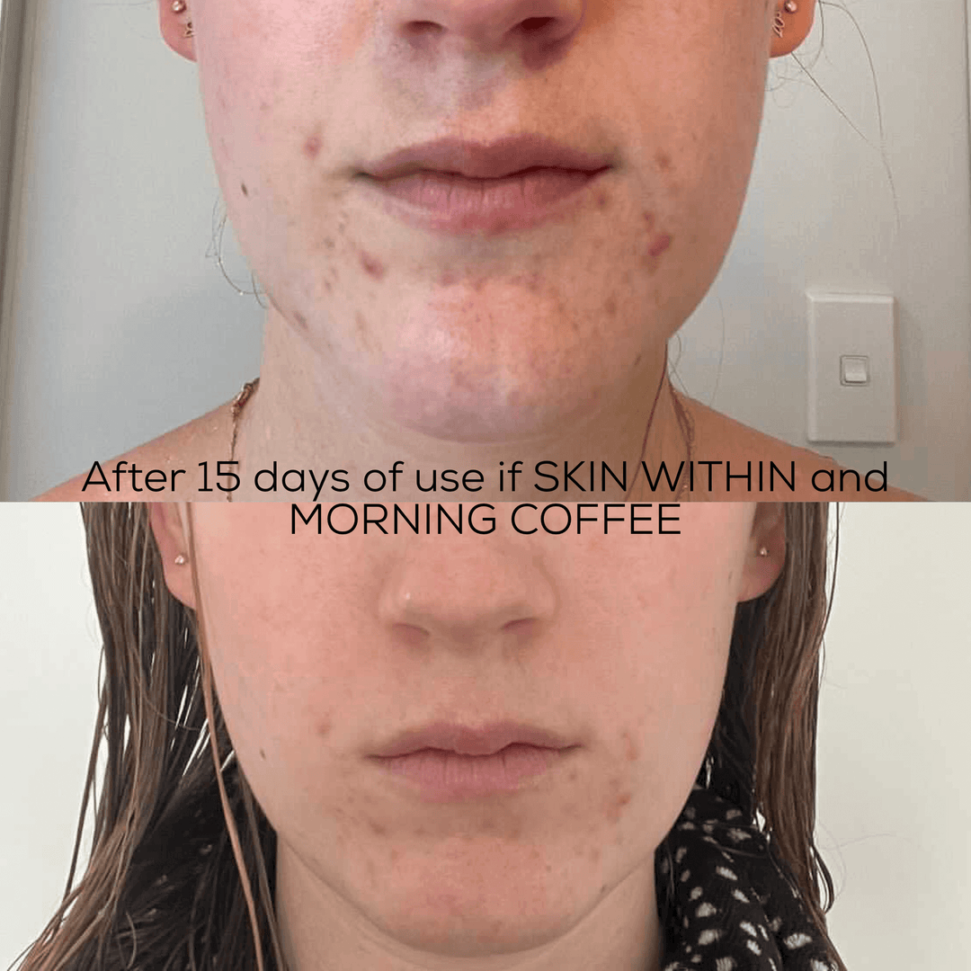 SKIN WITHIN Refill and Jar